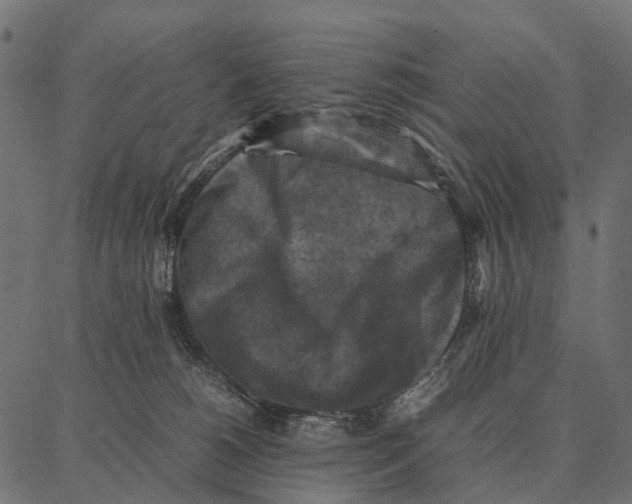 X0000087320180200705181020