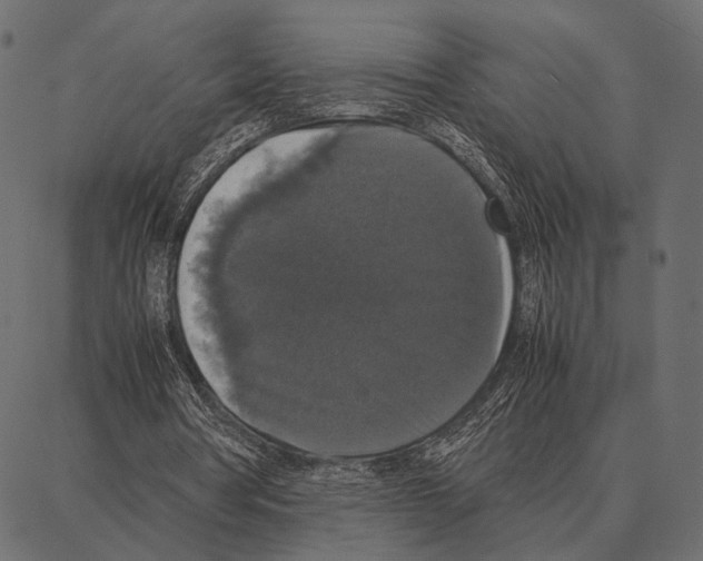 X0000087320386200705181016