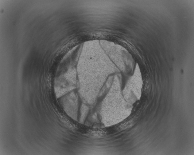 X0000087320466200705181015