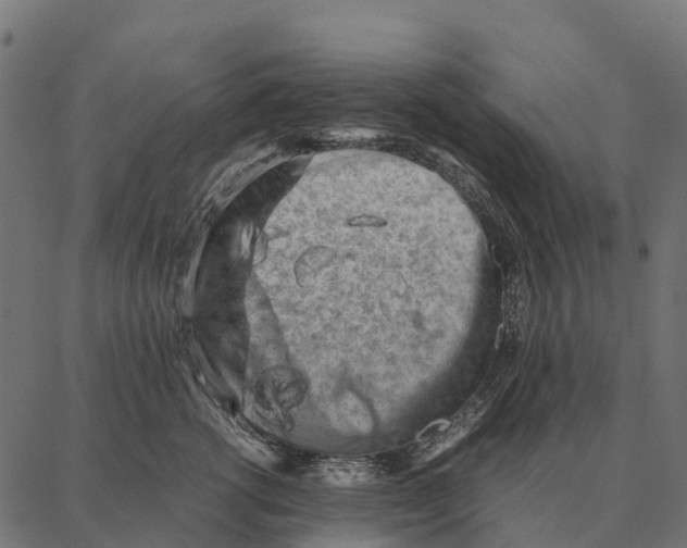 X0000087320762200705181011