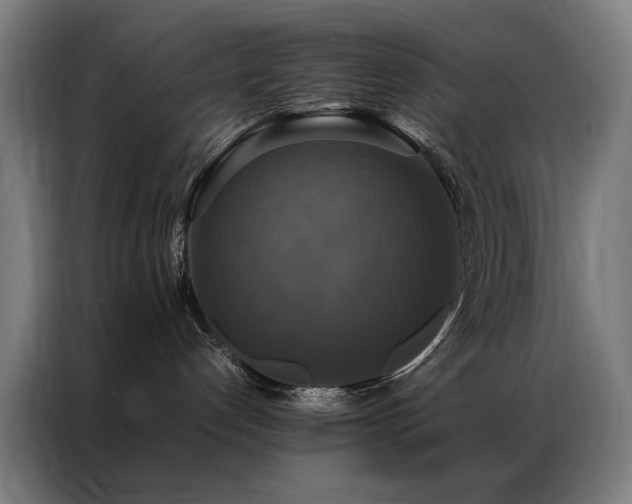X0000087330192200704201134
