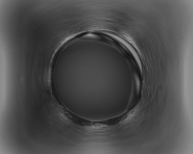 X0000087330387200704201131