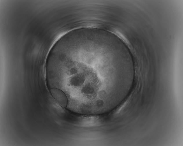 X0000087330891200704201126