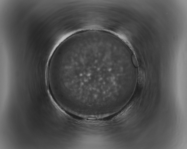 X0000087331295200704201121