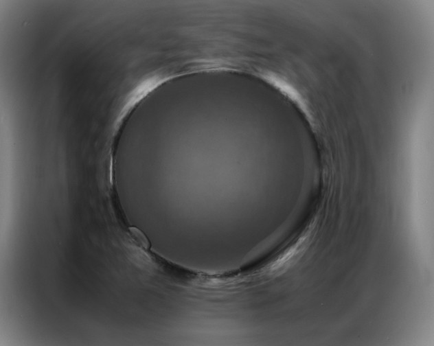 X0000087331365200704201120