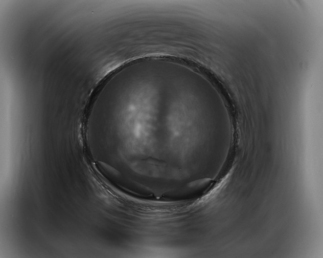X0000087331497200704201118