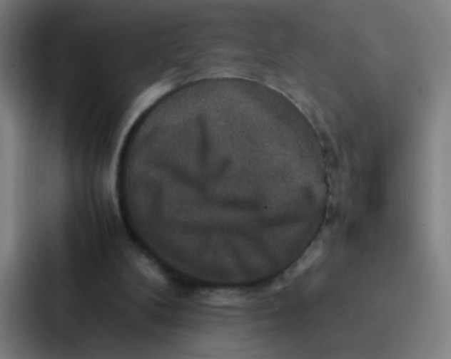 X0000087330104200705112205