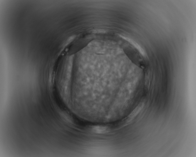X0000087330168200705112204
