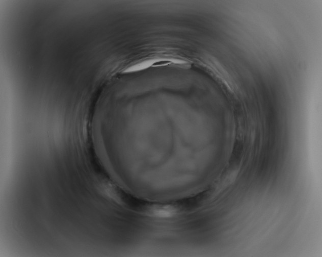 X0000087330169200705112204