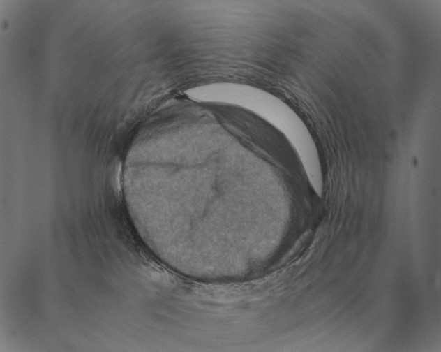 X0000087330041200705181047
