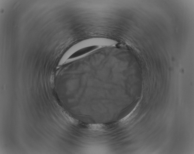X0000087330192200705181045