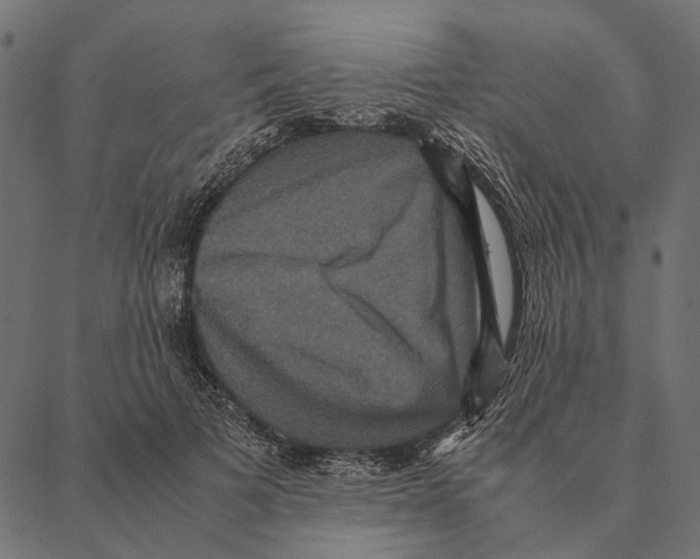 X0000087330697200705181036