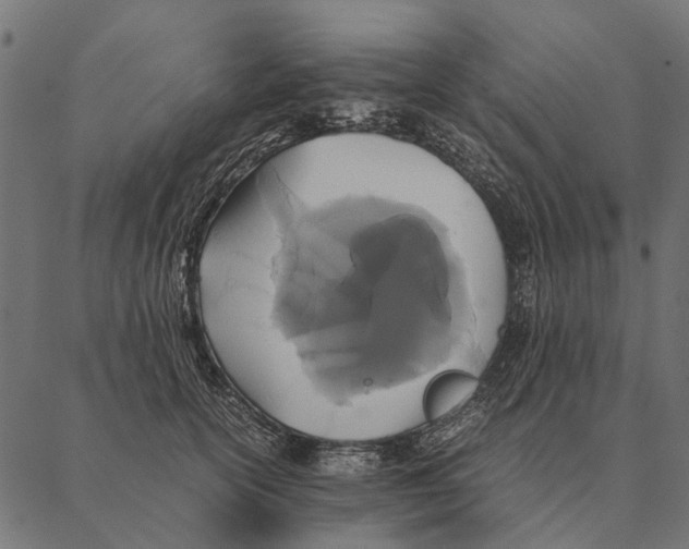 X0000087330754200705181036