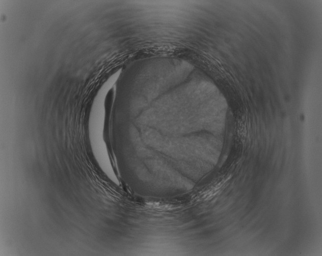 X0000087330818200705181034