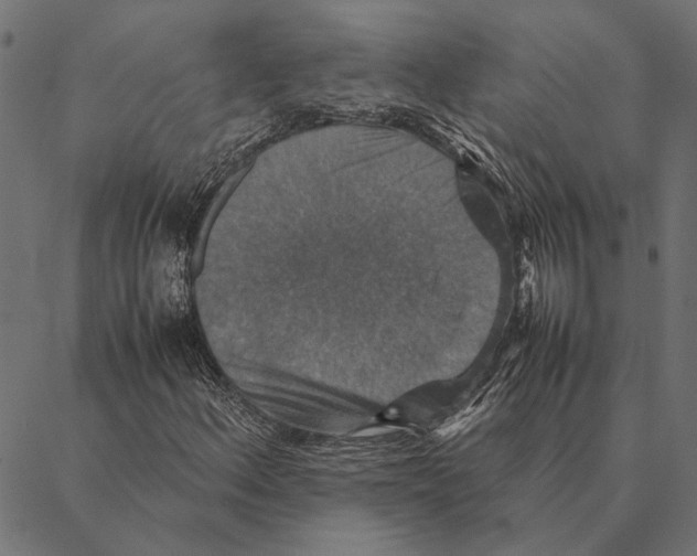 X0000087331156200705181029