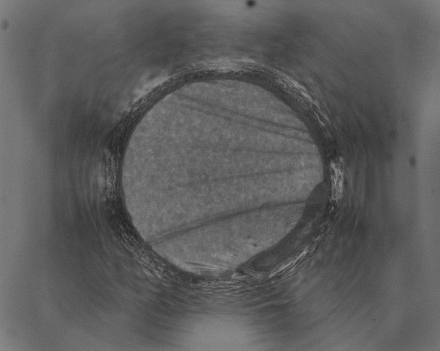 X0000087331158200705181029
