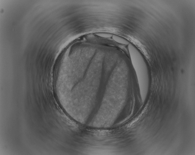 X0000087331184200705181028