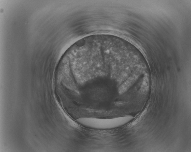 X0000087331533200705181023