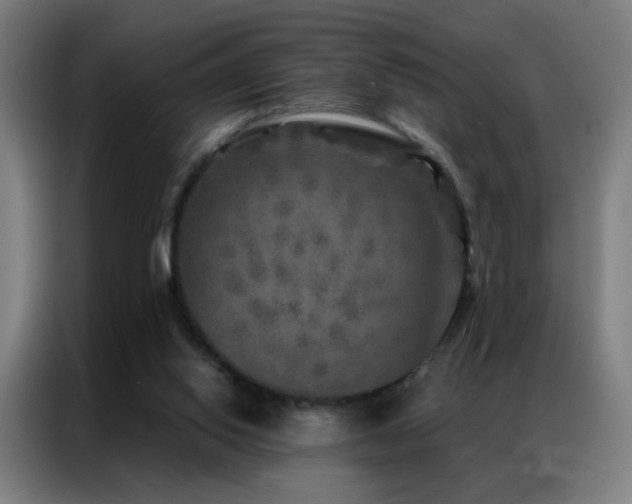 X0000087340062200704201152