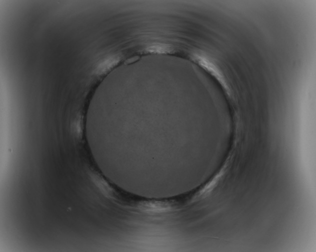 X0000087340305200704201150