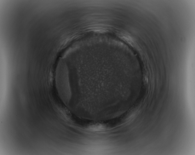 X0000087340551200704201147
