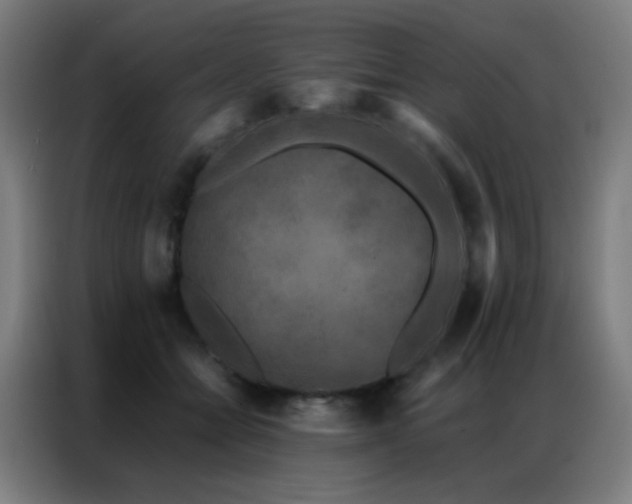 X0000087340558200704201147