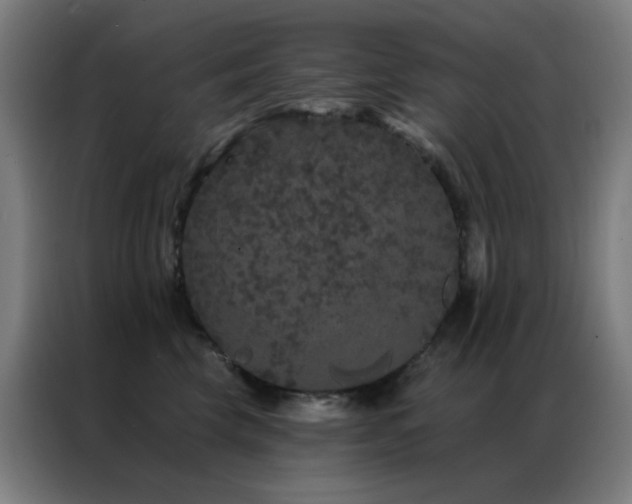 X0000087340569200704201147