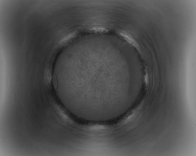 X0000087340593200704201147