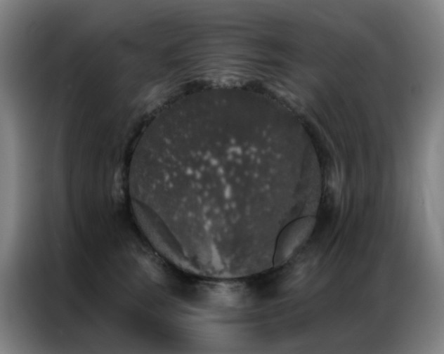 X0000087340663200704201146