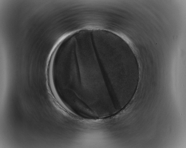X0000087340864200704201144