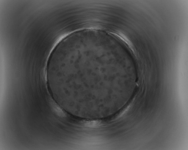 X0000087340891200704201143