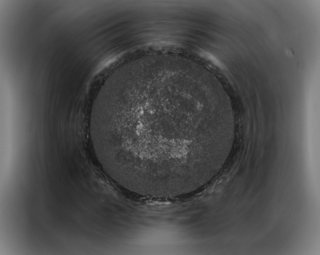 X0000087340919200704201143