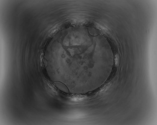 X0000087341059200704201141