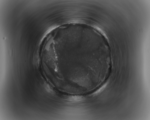 X0000087341117200704201140