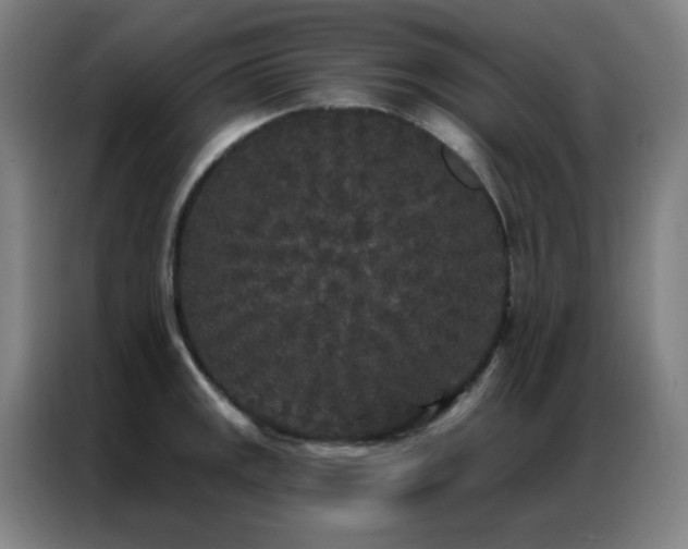X0000087341141200704201141