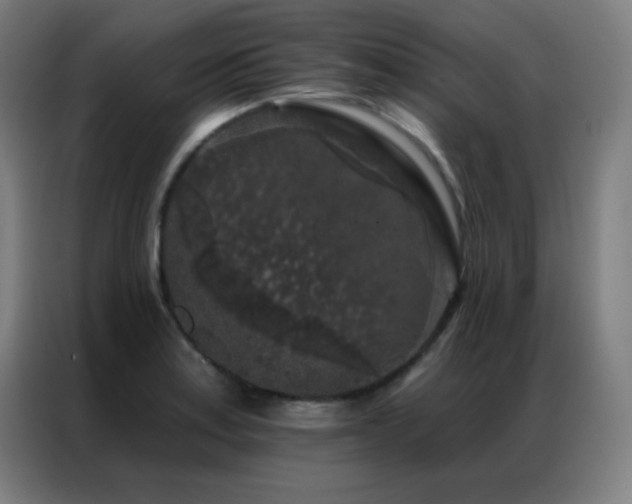 X0000087341179200704201140