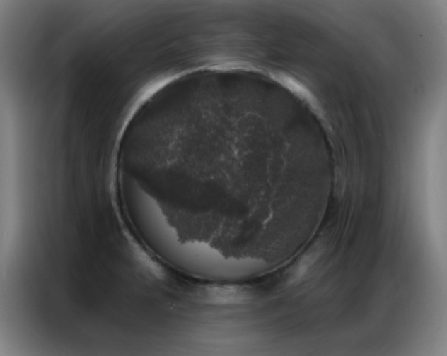 X0000087341231200704201140