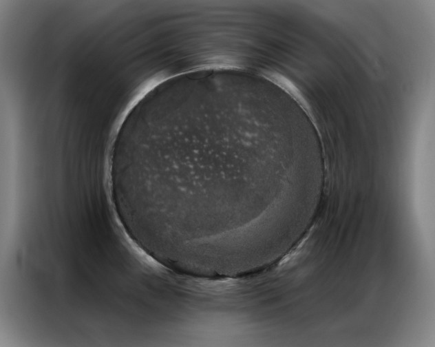 X0000087341243200704201140