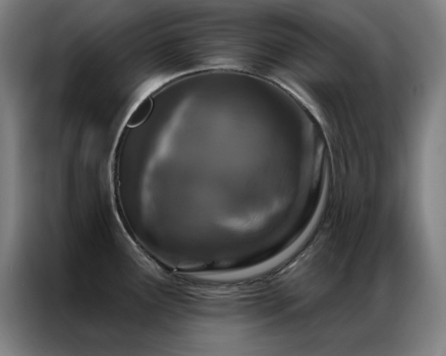 X0000087341291200704201139