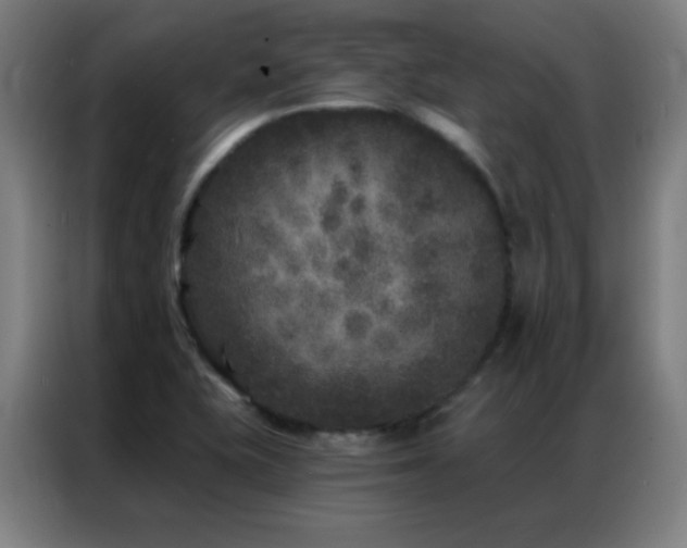 X0000087341415200704201137
