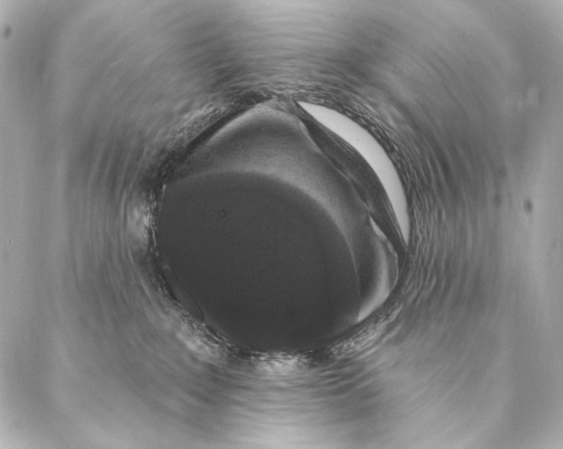X0000087340235200705111556