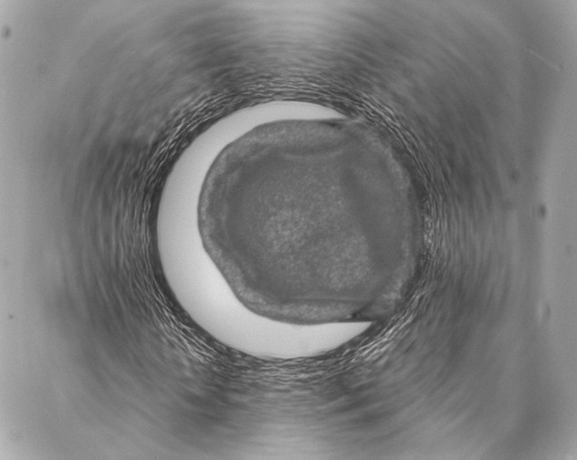 X0000087340818200705111545