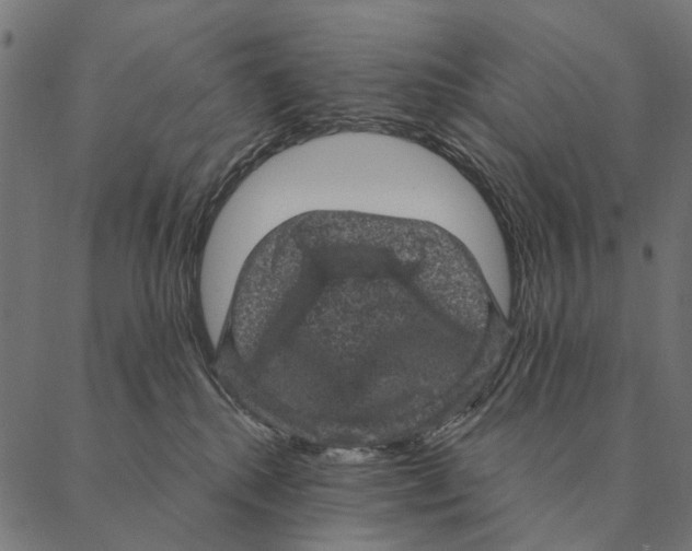 X0000087340280200705181109