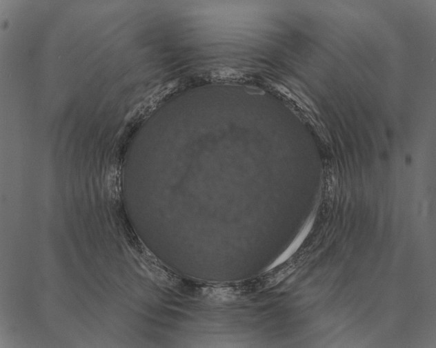 X0000087340419200705181106