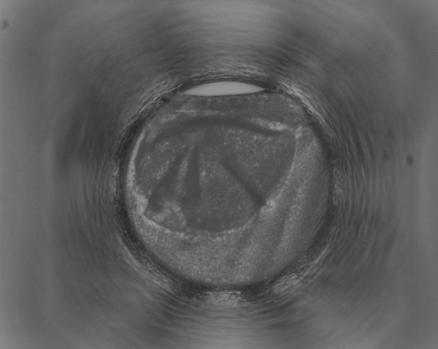 X0000087340451200705181105
