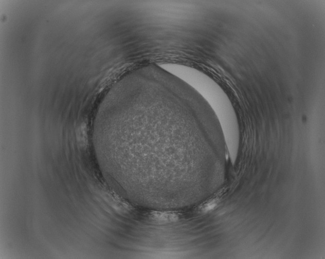 X0000087340520200705181104