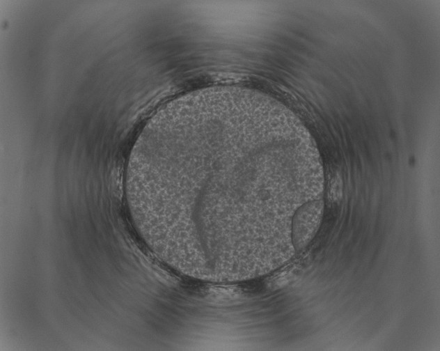 X0000087340666200705181102