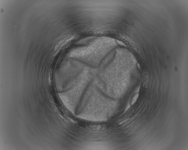 X0000087340740200705181101