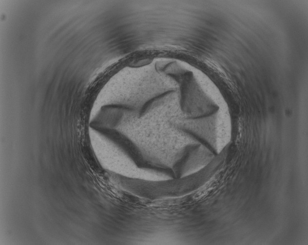 X0000087340872200705181059