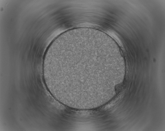 X0000087341000200705181056